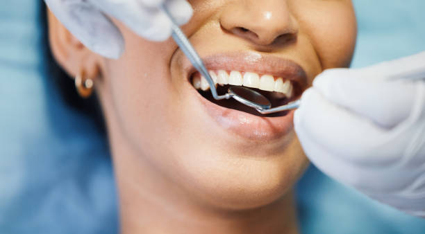Best Emergency Treatment for Dental Infections or Abscesses in Cordry Sweetwater Lakes, IN
