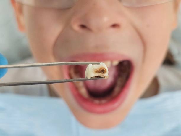 Best Cosmetic Emergency Dentistry in Cordry Sweetwater Lakes, IN