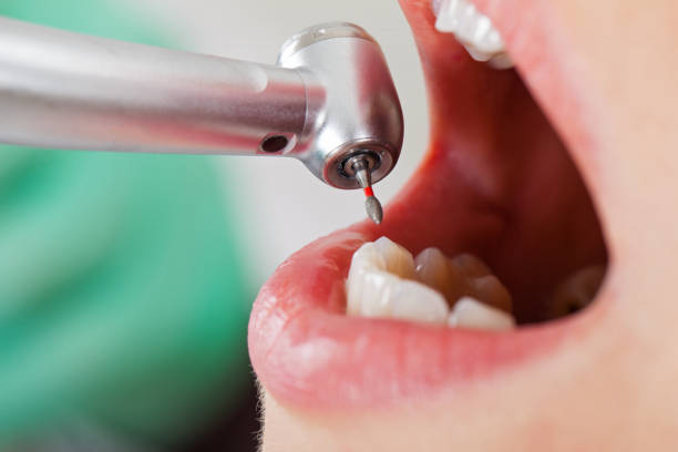 Best Same-Day Emergency Dental Services in Cordry Sweetwater Lakes, IN